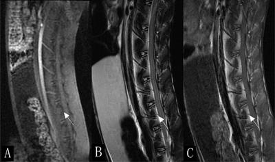 Evaluation of Bone Marrow Texture and Trabecular Changes With Quantitative DCE-MRI and QCT in Alloxan-Induced Diabetic Rabbit Models